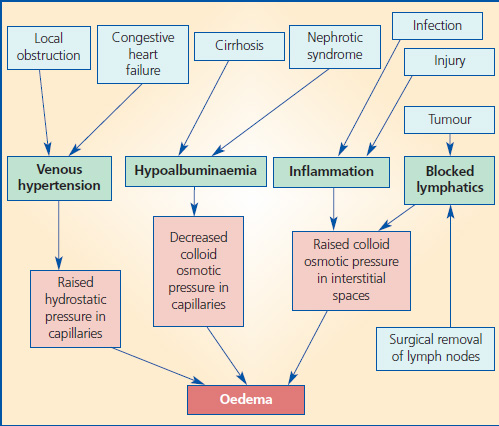 Edema Diagram For Nursing Process Steps