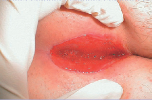 Diagnosis Treatment And Nursing Management Of Patients With